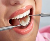fisher pointe blog dental filling procedure steps.jpg from filling