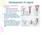 development of vagina35 l.jpg from 12 yr vagina