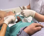 tumblr ook9cuhmqk1tuhyf8o7 400.jpg from female doctor watch penis circumcision