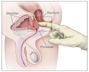 digital rectal examination rectal anatomy.jpg from male genital and rectal anatomy jpg