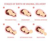 stages baby birth vaginal delivery stages baby birth vaginal delivery fetus movement labor biology 125838063.jpg from birth vagins