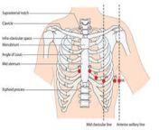 position ekg leads placement ecg showing ribs sternum mid clavicular line anterior axillary line created 61193105.jpg from 科珀斯克里斯蒂约炮【line：f68k69】身材一流 qyvi