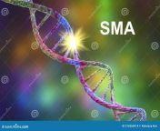 spinal muscular atrophy sma genetic neuromuscular disorder progressive muscle wasting loss motor neurons due to 216266914.jpg from cartoon sma