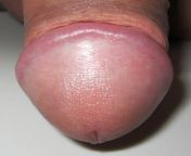 800px glans penis of a human.jpg from ছেলেদের নুনু ফটো হট