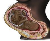 220px pregnancyincrosssection.jpg from pregnancy