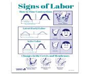 52567 signs of labor tear pad media 01 jpgresizeid8resizeh400resizew400 from birth contractions