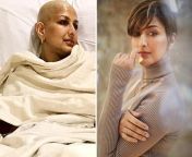 cancer survivour day sonali bendre recalls her cancer battle journey.jpg from sonali bendre sar