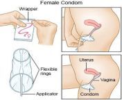 en3312905.jpg from how to use female condom by sunny leone vide
