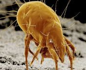 mite gettyimages 523568814.jpg from mites2