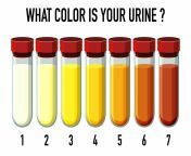 159378873 m scaled.jpg from urine d