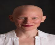  1.jpg from young bald pussy pics