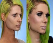 facial feminization transgender surgery toronto.jpg from female and fem