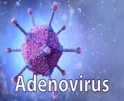 adenovirus blog 1080x675.jpg from adenovirus 1s 4 jpg