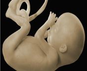 150407092620 bangla fetus 640x360 bbc nocredit.jpg from চুদা চুদি বাচ্চাদের বাংলাদেশি
