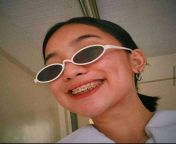 14a0e03f9526a468bc1bc89923d9a770.jpg from braces pinay