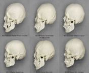 7322909530a78b3744c21615c6c17049.jpg from skull gall