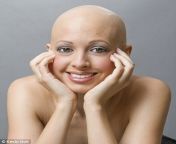 article 0 05bbe0fb000005dc 127 468x494.jpg from bald pussy selfie