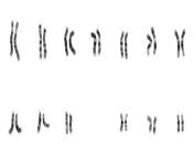 nhgri human male karyotype 1 jpgresize1920768ssl1 from nxn xxx sex 20