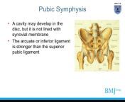 anatomy of pubic symphysis and sacroiliac joint wwwammedicinecom 4 1024 jpgcb1386761904 from pubic