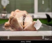eine tote frau liegt auf einem tisch von der depanrtmend fur forensische rechtsprechung in brandenburg d9p68c.jpg from autopsy footage on dead women recorded by medical student