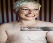 a portrait of a mature woman with mastectomy scars jpgs612x612wgik20c1ttphdvxsxqneqmuei rtoczax3ike6nveuohzl d50 from flat tits