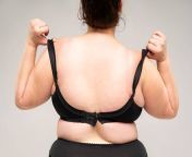 overweight woman with fat back obesity female body on gray background jpgs612x612w0k20czsiqbof2qhlhqohsl7nqddx0cbs9venwiigzbahvoui from fat women back