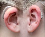5122 cross bicross hearing aids.jpg from photos hearing