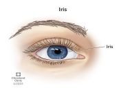 22502 iris from iris