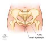 23025 pubic symphysis from pubis