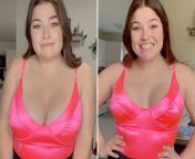 breast reduction surgery comp jpgquality75stripall from big boobs op