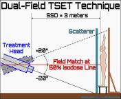 dual field tset technique omp 2.png from tset