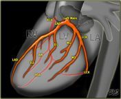 a5097978475133 coronary anatomy lat1.png from and lad