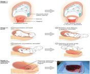 lifespandevelopment30.jpg from vulva infant