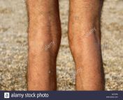 male hairy legs xd7ap8.jpg from pic womens haire legs