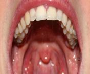 ilustrasi rongga mulut.jpg from pancut dalam mulut