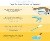 an infographic showing what to expect during a pap smear.jpg from pap