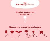 normal sperm vs abnormal sperm morphology 1024x1024 jpgv1689235474 from pregnantsperm