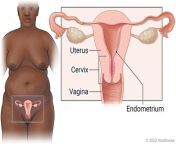 acn8401 460x300.jpg from my uterus waits for your cum