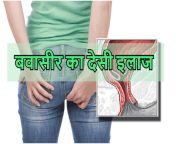 बवासीर का देसी इलाज 1.jpg from देसी आर्म