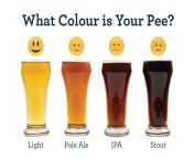 what colour is your pee 1200x800.jpg from urine eat