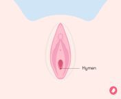 7608 what is a hymen1006x755 1 jpgv1 0 from virgin sex vagina period time porn xxx