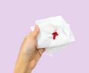 7747 blood on tissue1006x755 jpgv1 0 from bleeding sex